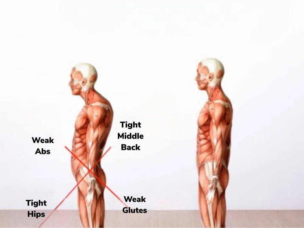 Good and Bad Posture Illustration